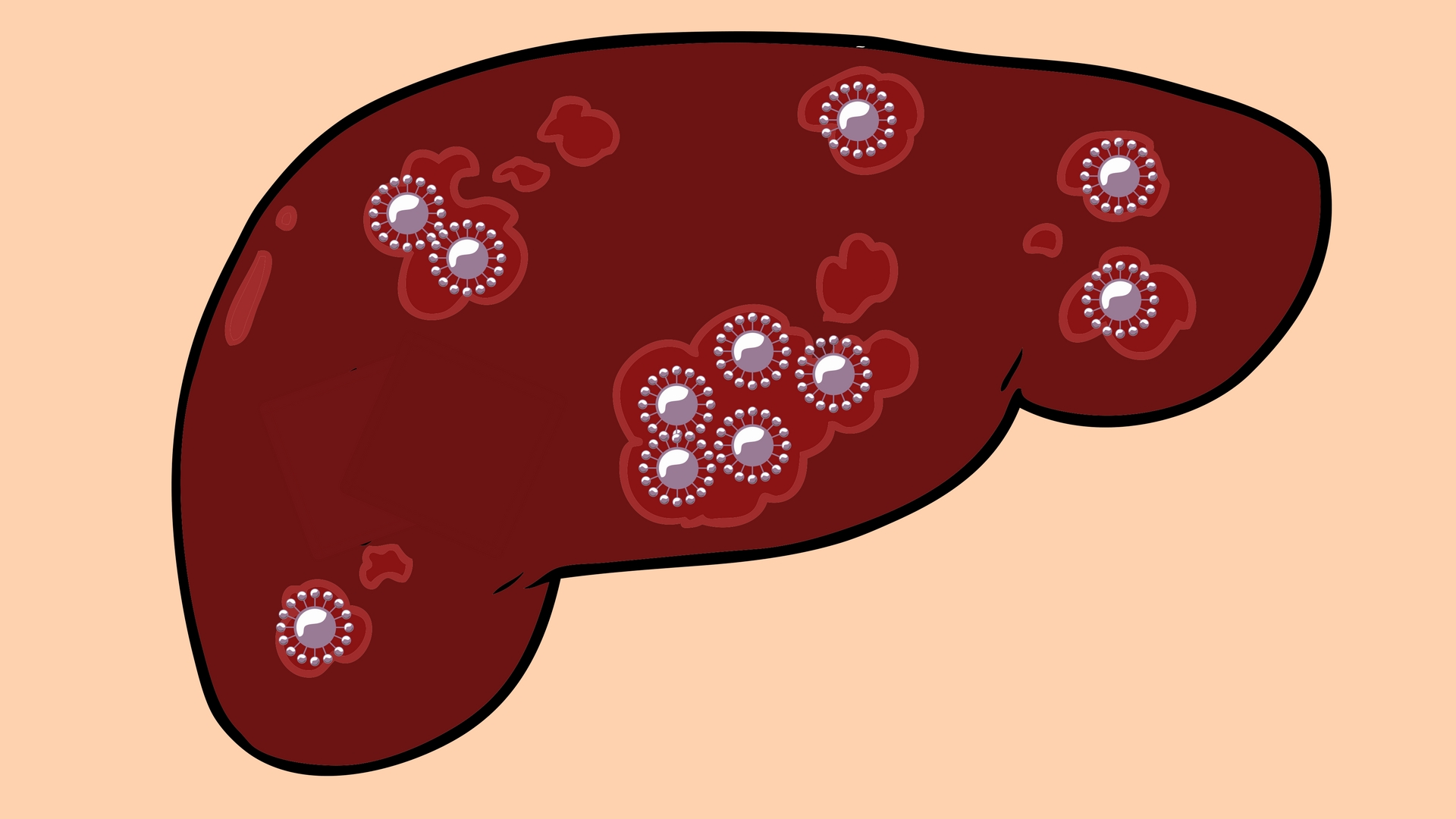 Hepatitis C Virus Treatment Cheaper in India with Generic Directly Acting Antivirals